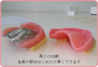 金属床義歯のイメージ動画